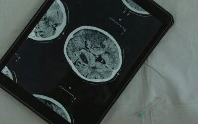 The Science of Addiction and How PHP and IOP Support Brain Recovery